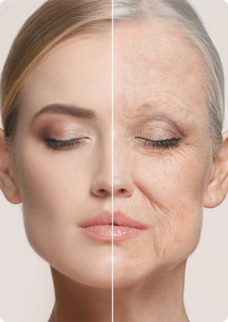 Anti Wrinkles