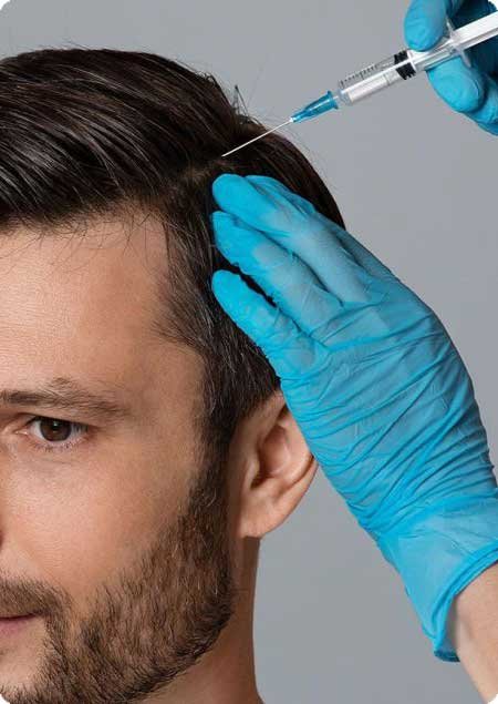 PRP for Hair Restoration